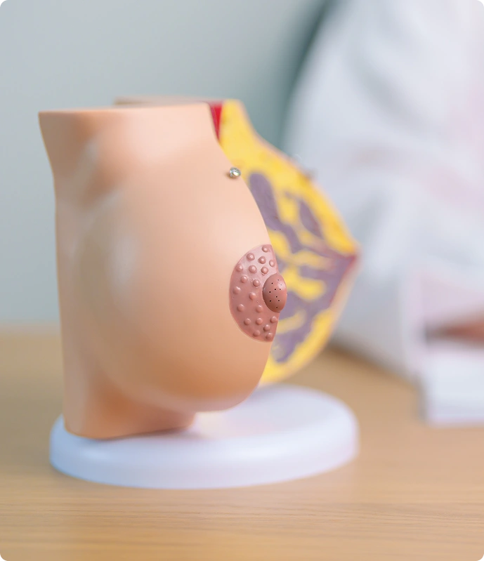 A side-view anatomical breast model on a clinic desk used to explain surgical procedures during a consultation.