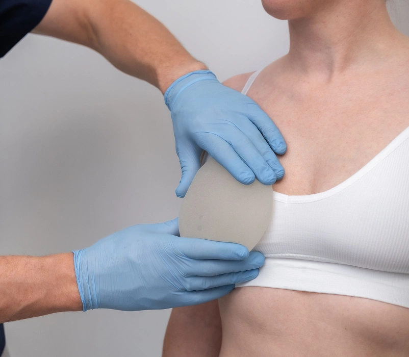 A plastic surgeon in blue medical gloves positioning a textured silicone implant against a patient wearing a white top during a reconstruction consultation.