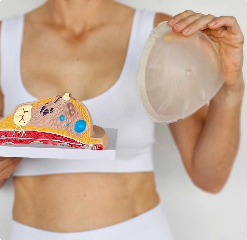 A woman holding an anatomical breast cross-section model and a clear silicone breast implant to illustrate breast cancer reconstructive options.