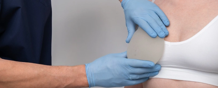 A surgeon in blue medical gloves holding a silicone implant against a patient to assess breast augmentation sizing.